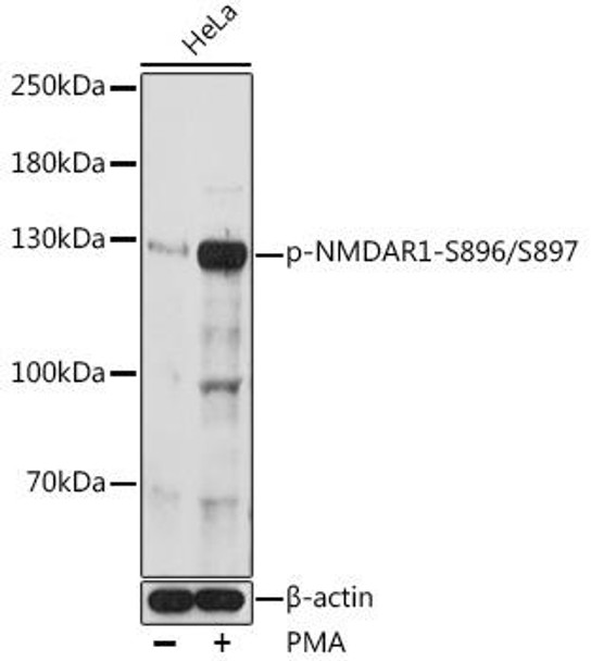 Anti-Phospho-NMDAR1-S896/S897 Antibody (CABP0962)