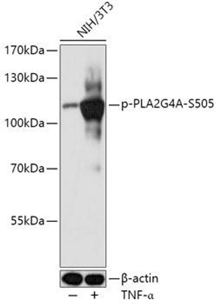 Anti-Phospho-PLA2G4A-S505 Antibody (CABP0968)