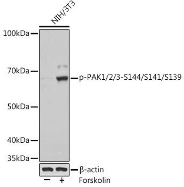 Anti-Phospho-PAK1/2/3-S144/S141/S139 Antibody (CABP1158)