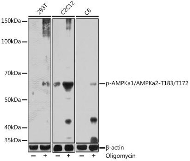 Anti-Phospho-AMPKa1/AMPKa2-T183/T172 Antibody (CABP1171)
