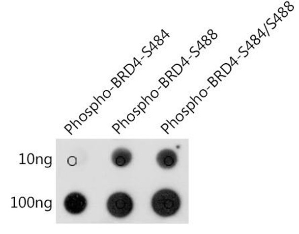 Anti-Phospho-BRD4-S484/S488 Antibody (CABP1177)
