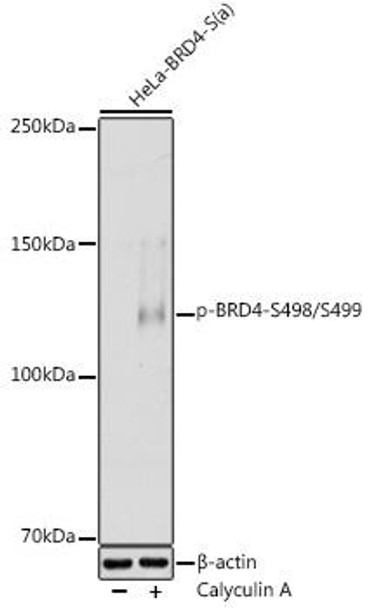 Anti-Phospho-BRD4-S498/S499 Antibody (CABP1179)