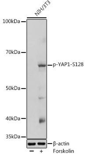 Anti-Phospho-YAP1-S128 Antibody (CABP1187)