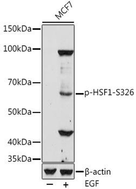 Anti-Phospho-HSF1-S326 Antibody (CABP1189)