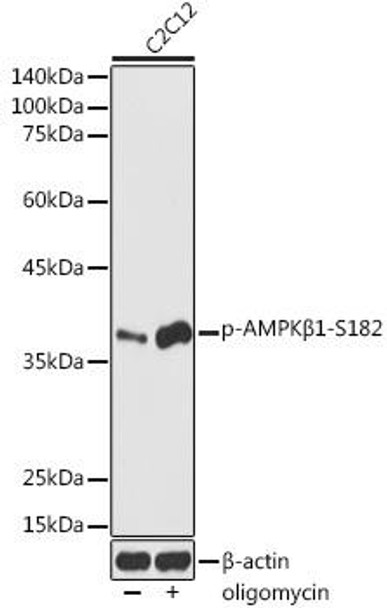 Anti-Phospho-AMPKbeta1-S182 Antibody (CABP1195)