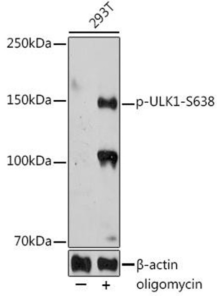 Anti-Phospho-ULK1-S638 Antibody (CABP1196)