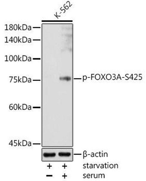 Anti-Phospho-FOXO3A-S425 Antibody (CABP1200)