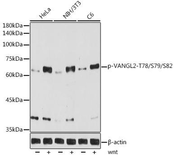 Anti-Phospho-VANGL2-T78/S79/S82 Antibody (CABP1206)