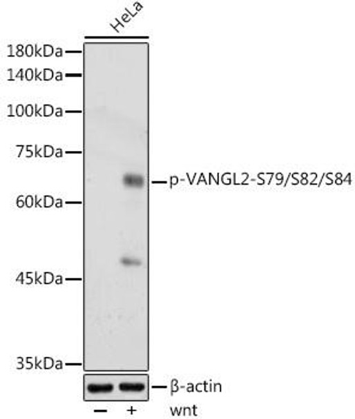 Anti-Phospho-VANGL2-S79/S82/S84 Antibody (CABP1207)