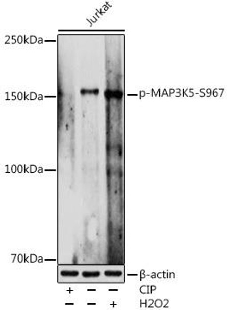Anti-Phospho-MAP3K5-S967 Antibody (CABP1217)