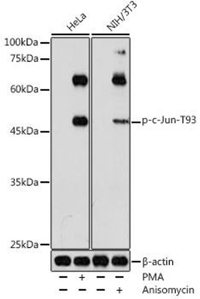 Anti-Phospho-c-Jun-T93 Antibody (CABP1218)