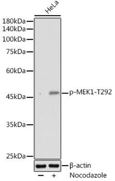 Anti-Phospho-MEK1-T292 Antibody (CABP1221)