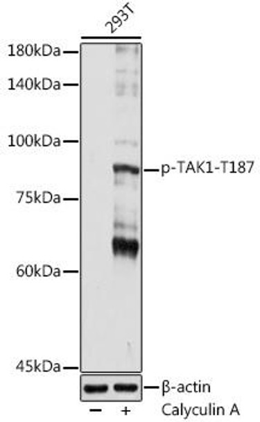 Anti-Phospho-TAK1-T187 Antibody (CABP1222)