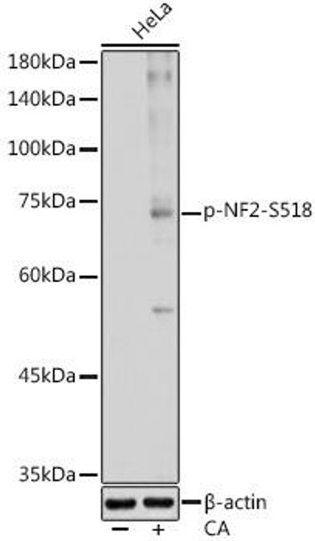 Anti-Phospho-NF2-S518 Antibody (CABP1225)