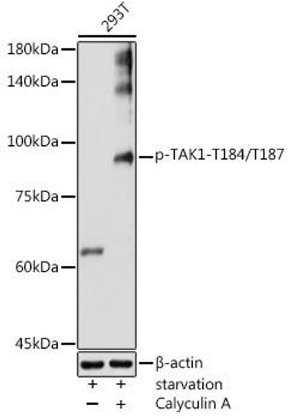 Anti-Phospho-TAK1-T184/T187 Antibody (CABP1227)