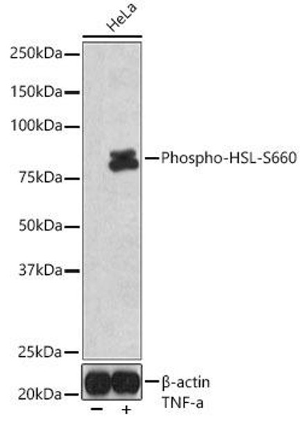 Anti-Phospho-HSL-S660 Antibody (CABP1242)