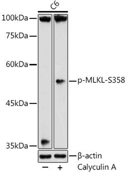 Anti-Phospho-MLKL-S358 Antibody (CABP1244)