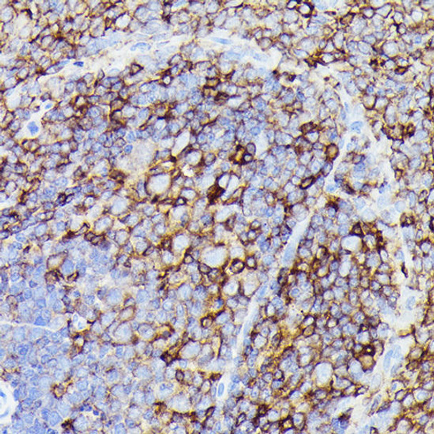 Anti-Siglec-15 Antibody (CAB20773)