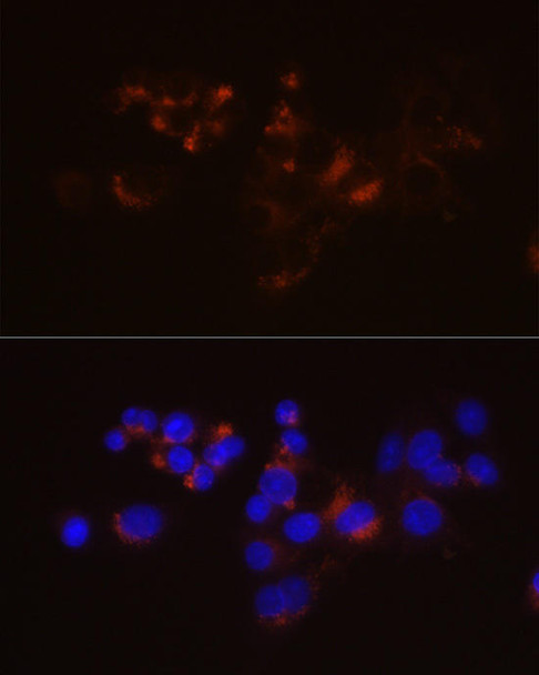 Anti-LDL Receptor (LDLR) Antibody (CAB20808)