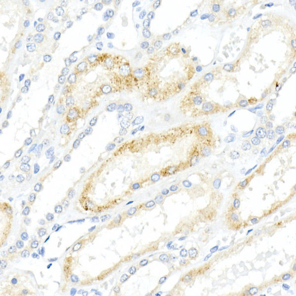 Anti-AMACR Antibody (CAB20825)