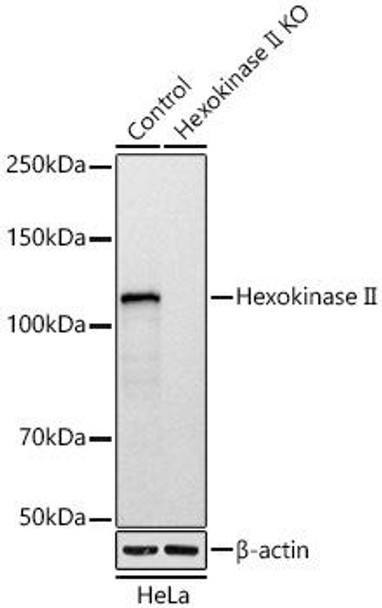 Anti-Hexokinase II Antibody [KO Validated] (CAB20829)