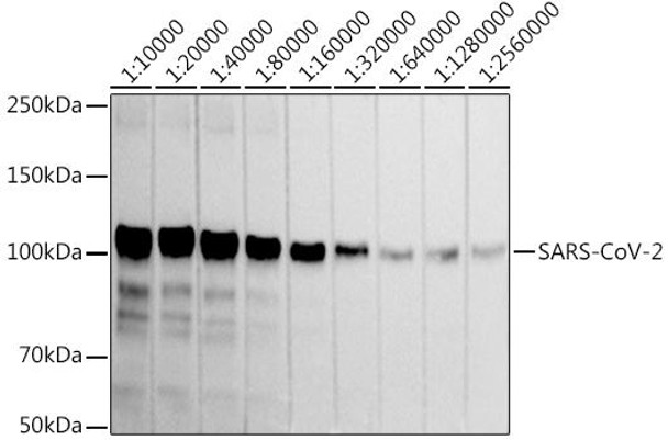 Anti-SARS-CoV-2 Spike S1 Antibody (CAB20834)