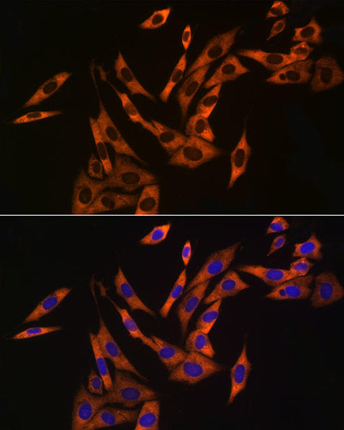 Anti-UBA52 Antibody (CAB20876)