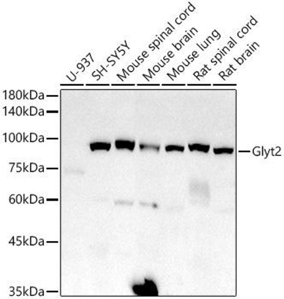 Anti-Glyt2 Antibody (CAB20931)