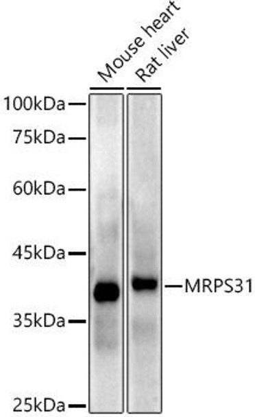 Anti-MRPS31 Antibody (CAB20932)