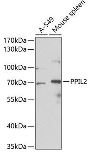 Anti-PPIL2 Antibody (CAB4579)