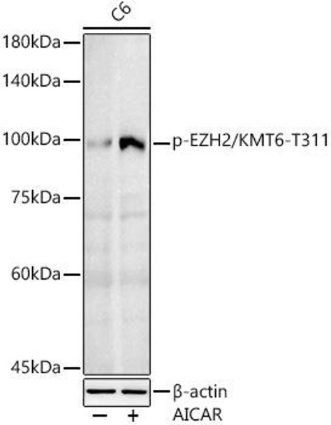Phospho-EZH2/KMT6-T311 Antibody (CABP1269)