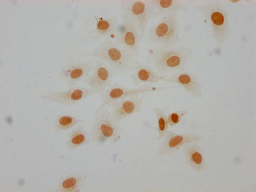 Mono-methyl-HIST1H1D (K16) Antibody (PACO65052)