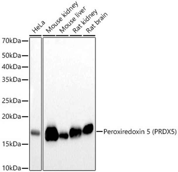 Peroxiredoxin 5 (PRDX5) Monoclonal Antibody