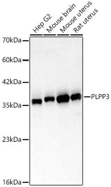 PLPP3 Monoclonal Antibody