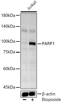 PARP1 Polyclonal Antibody (CAB22534)