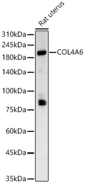 COL4A6 Polyclonal Antibody