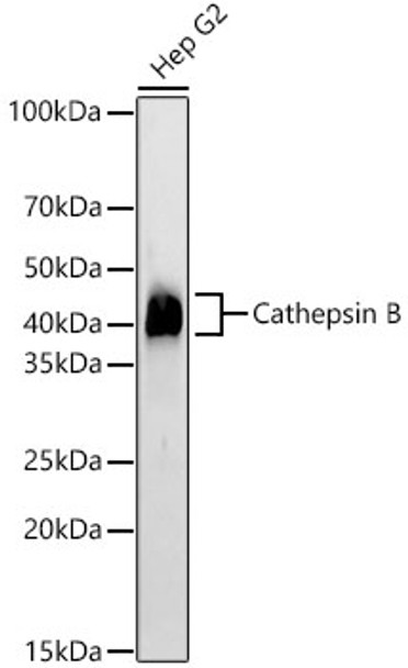 Cathepsin B Monoclonal Antibody