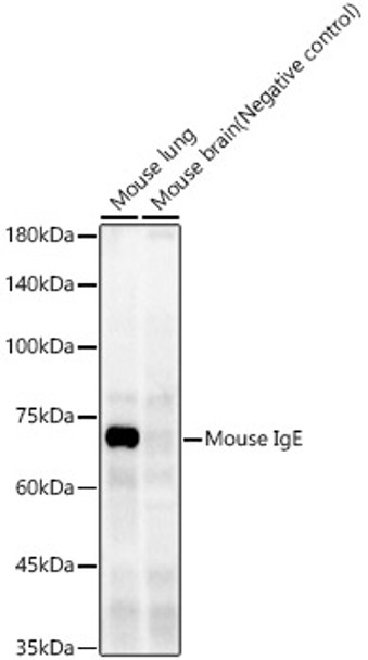 Mouse IgE Monoclonal Antibody