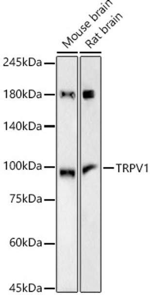 TRPV1 Monoclonal Antibody