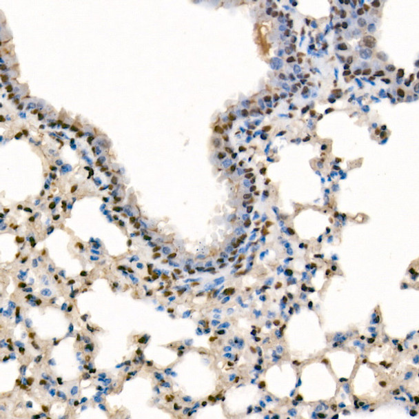 SETD1B Polyclonal Antibody