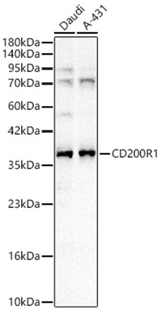 CD200R1 Polyclonal Antibody