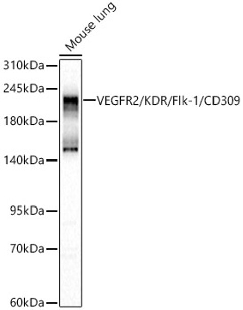 VEGFR2/KDR/Flk-1/CD309 Polyclonal Antibody VEGFR2/KDR/Flk-1/CD309 Polyclonal Antibody