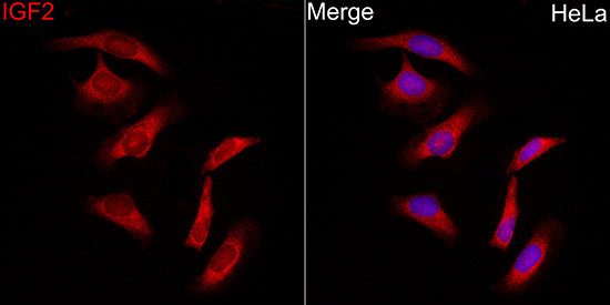 IGF2 Polyclonal Antibody