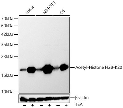 Acetyl-Histone H2B-K20 Polyclonal Antibody