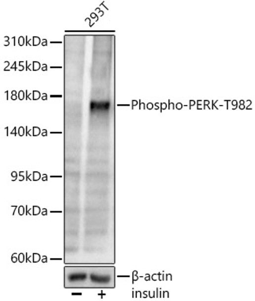 Phospho-PERK-T982 Monoclonal Antibody (CABP1501)