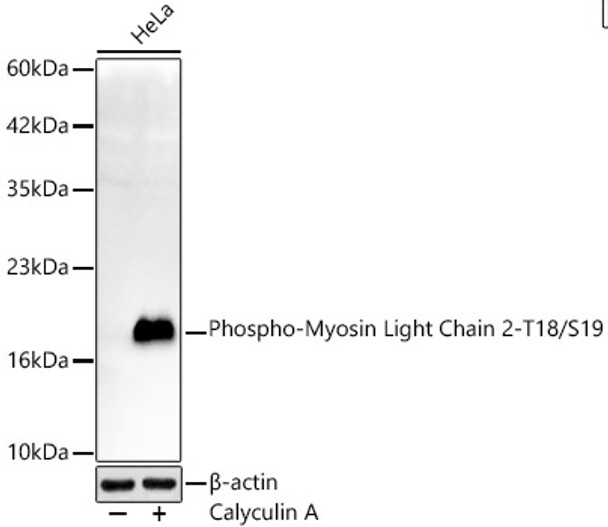 Phospho-Myosin Light Chain 2-T18/S19 Monoclonal Antibody
