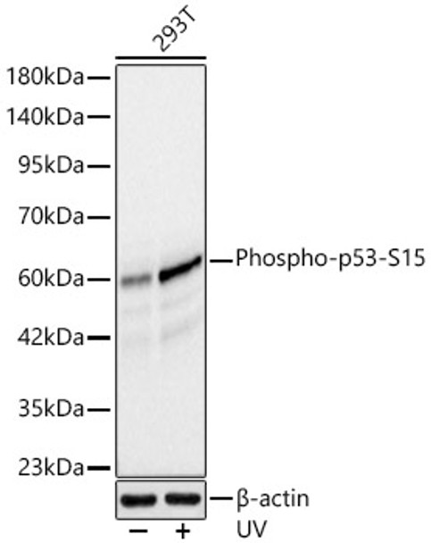 Phospho-p53-S15 Monoclonal Antibody