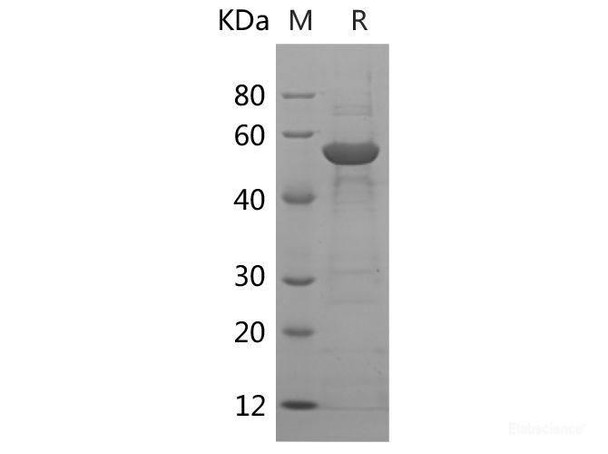 Human PBEF/NAMPT Recombinant Protein (His Tag)