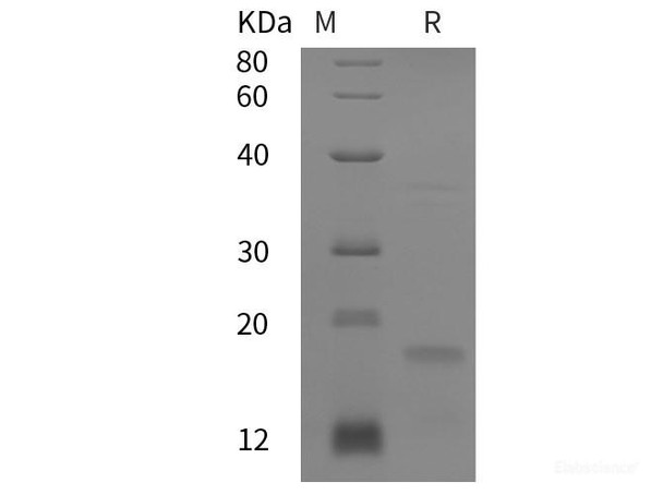 Human P21 Recombinant Protein (His tag) Human P21 Recombinant Protein (His tag)