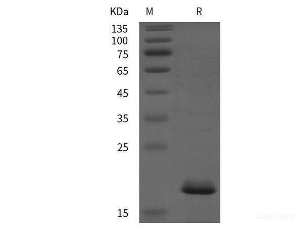 Human TRAPPC8 Recombinant Protein (His tag)